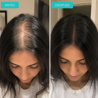 Recupera tu cabello