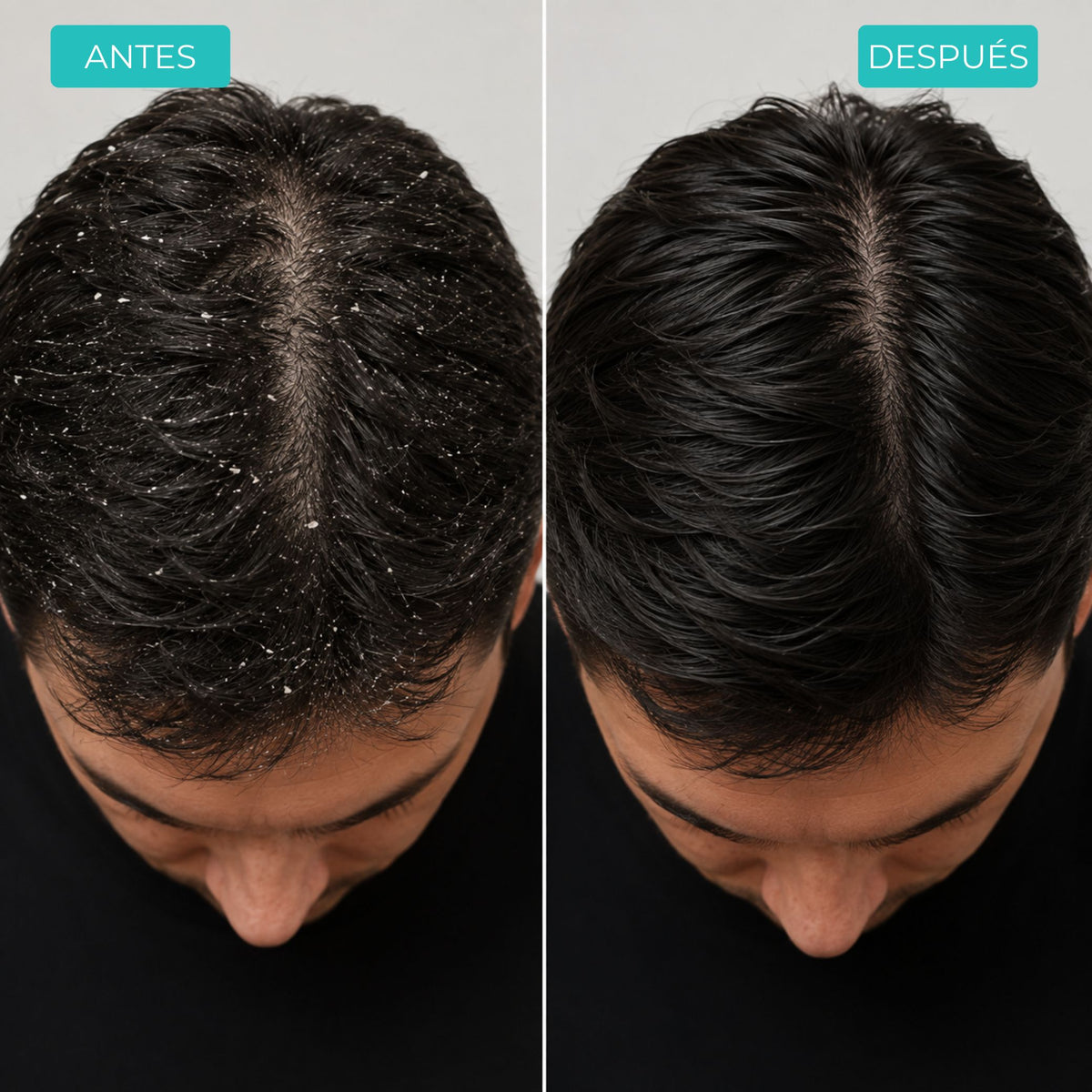 Recupera tu cabello
