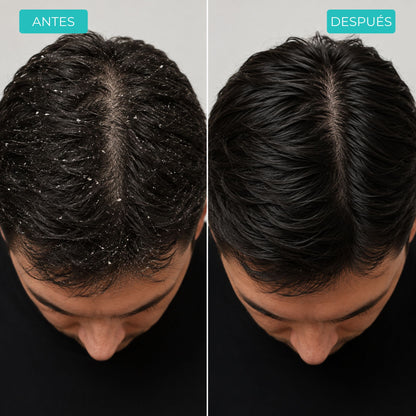 Recupera tu cabello